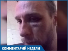 «Обливают зеленкой, кидают гранаты во двор, избивают»: ставропольский журналист поделился догадками о нападении 