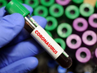 Хорошие новости о CoVID-19: ученые нашли препарат, подавляющий вирус