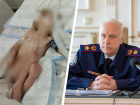 Глава Следкома России заинтересовался ситуацией с истощенным ребенком на Ставрополье