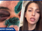 «Теперь можешь его убивать»: ставропольчанка рассказала о жестоком избиении отца соседями