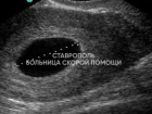 Контрацептивы не сработали: реальная история пациентки из Ставрополя