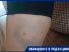 «Плачу от испуга»: бродячие собаки напали на жительницу Светлограда на Ставрополье 