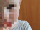 В частном детском саду в Ставрополе могли избить мальчика