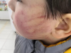 Воспитательница детского сада в Георгиевске избила ребенка за непослушание