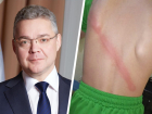 Есть вещи, которые должны оставаться в прошлом ― губернатор Ставрополья об избиении 12-летнего кадета плетью