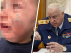 Глава следкома РФ Бастрыкин поручил провести проверку по нападению собак на женщину с ребенком в Минводах 