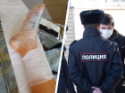 После ДТП с пострадавшей девочкой на Ставрополье полиция начала проверку