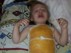 Двухлетняя девочка получила ожоги в детском саду Буденновска