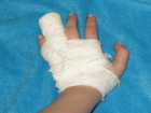Столкновение с джипом закончилось переломом пальца для ставропольского подростка