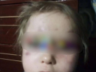 Истязавшего 3-летнюю девочку отца арестовали на Ставрополье