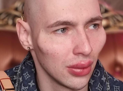«Руки-базуки» со Ставрополья после скул инопланетянина сделал «губы-пельмени»