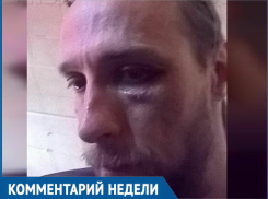 «Обливают зеленкой, кидают гранаты во двор, избивают»: ставропольский журналист поделился догадками о нападении 