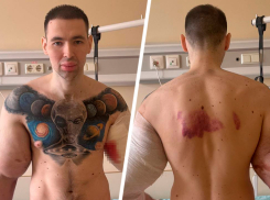 Снявшегося в порно блогера из Пятигорска Руки Базуки экстренно прооперировали: первые кадры