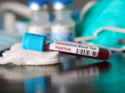 Еще у 85 ставропольцев выявили коронавирус