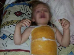 На воспитательницу детсада Будённовска завели уголовное дело за пролитый на ребёнка кипяток 