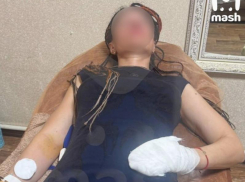 Ампутация пальца и потеря работы грозят стилисту из Ставрополья после похода на гору Хан-Тенгри