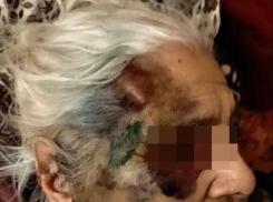 Уголовное дело возбудили по факту предполагаемого избиения пенсионерки во 2 горбольнице Ставрополя