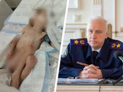 Глава Следкома России заинтересовался ситуацией с истощенным ребенком на Ставрополье