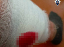 Нападение стаи собак на женщину в Минводах стало поводом для уголовного дела