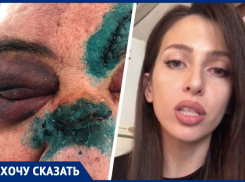 «Теперь можешь его убивать»: ставропольчанка рассказала о жестоком избиении отца соседями
