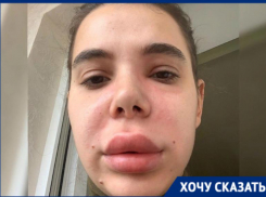 «Я думала, что умру прямо в кресле», — ставропольчанка пострадала от рук косметолога-дилетанта 