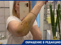 «Нечего было махать руками»: жительниц Ставрополя покусала собака без поводка и намордника