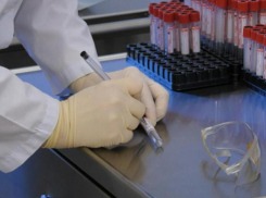 На Ставрополье выявлено 8 новых случаев заражения CoVID-19