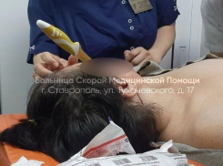 Вонзила нож в голову и попала в больницу женщина из Ставрополя