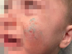 Свора собак напала на мать с ребенком на Ставрополье