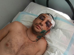 Молодого отца троих детей избили толпой в Лермонтове