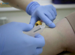 Поражающая кожу и глаза болезнь гуляет по территориям трех округов на Ставрополье 