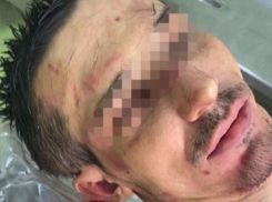 Садистам из пятигорского рехаба с бесчеловечными пытками назначили наказание