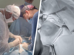 Кисту размером с яблоко удалили подростку хирурги в Пятигорске