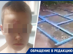 «Весь в крови был»: 10-летнего ребенка в Ставрополе придавило ограждением детской площадки 