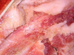 Мясо с червями принесла домой из магазина жительница Ставрополья