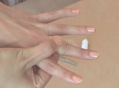 Жительнице Ставрополя спасли палец, застрявший в кольце