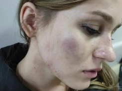 В Михайловске неизвестный жестоко избил девушку в 50-ти метрах от дома