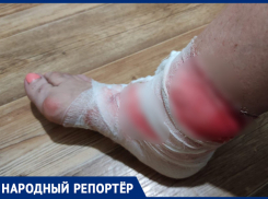 «Крови было много»: электросамокатчик сбил 67-летнюю женщину в Ставрополе 