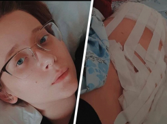 В Ессентуках фельдшер скорой из-за водителя-лихача потеряла ногу 