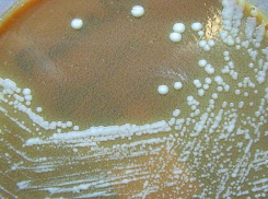 Из-за заражения людей туляремией через водопроводные сети возбудили дело на Ставрополье