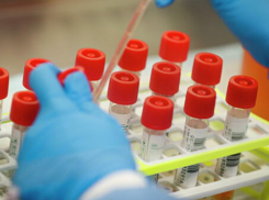 Минздрав: 18 отрицательных результатов показали тесты на коронавирус у пациентов группы риска