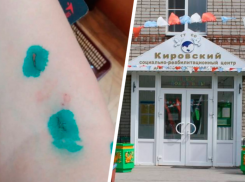 Об избиении юных воспитанников в реабилитационном центре Ставрополья заявили в соцсетях. Руководство отрицает  