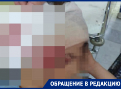 Мальчик разбил голову из-за сломанной качели в Минеральных Водах 