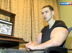 «Синтоловый качок» из Пятигорска рассказал сколько стал зарабатывать после накачки рук масляной смесью