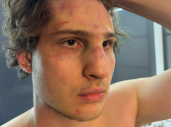 «Я ветеран войны»: ссора из-за вызванного лифта закончилась для ставропольца сломанным носом и синяками