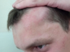 Следственный комитет проверит дело об избитом в ГАИ жителе Буденновска 