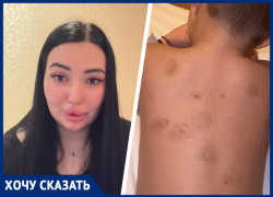 Кусали дети, но виноваты взрослые: мама травмированного в детсаду ребенка обратилась к губернатору Ставрополья