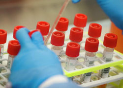 Еще у 72 ставропольцев подтвердился коронавирус