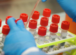 На Ставрополье уже больше полутора тысяч больных коронавирусом