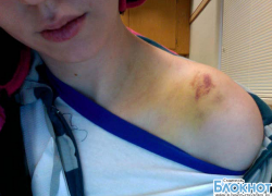 Житель Ставрополя избил девушку за отказ вступить с ним в интимную связь